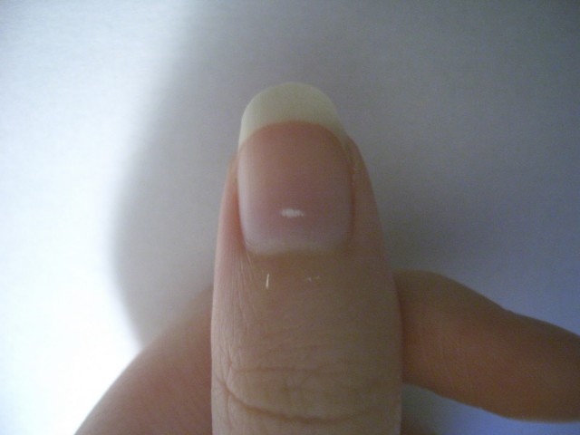 Nails et votre santé Ногти и ваше здоровье
