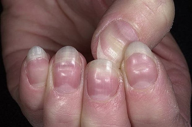 Nails et votre santé Ногти и ваше здоровье