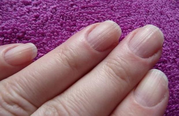 Nails et votre santé Ногти и ваше здоровье