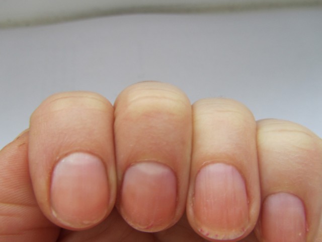 Nails et votre santé Ногти и ваше здоровье